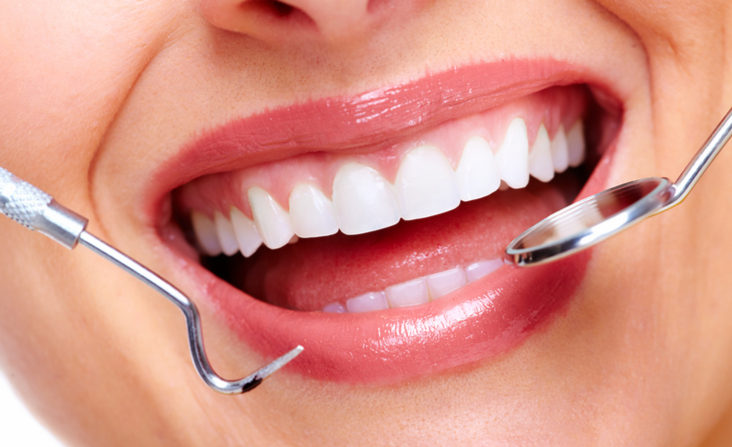 Paciente con una sonrisa radiante después de carillas de resina compuesta en Sense Dental Center en Orlando, FL