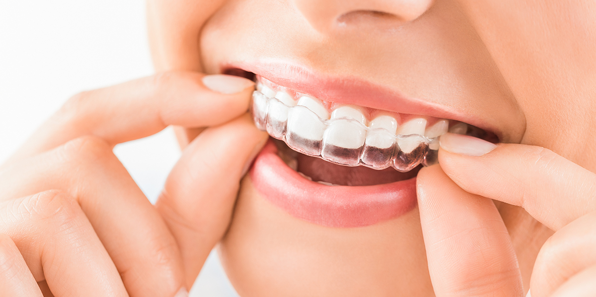 Paciente comparando diferentes tipos de tratamiento de ortodoncia en Sense Dental Center en Orlando, FL