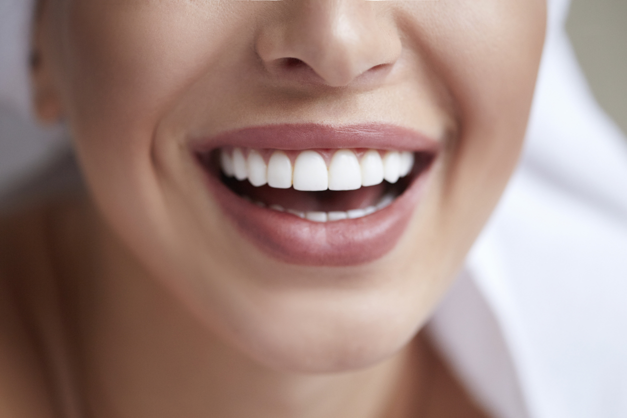 Trabajo de restauración prostodóntica en Sense Dental Center en Orlando, FL