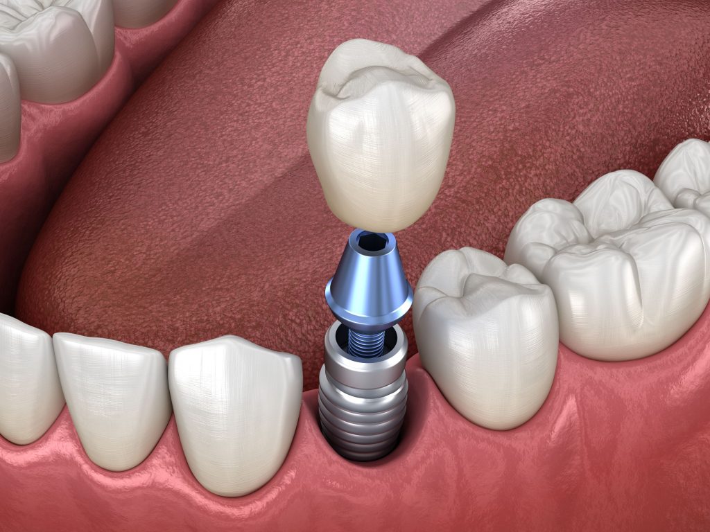 Paciente recebendo atendimento urgente de um dentista de emergência em Orlando